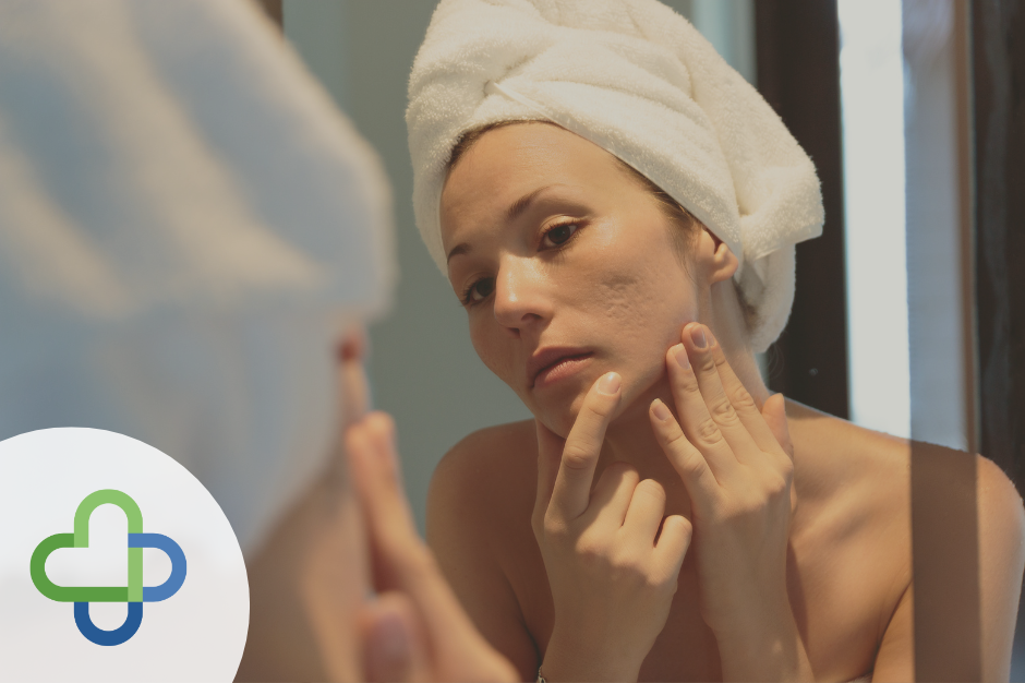 woman looking in mirror at acne