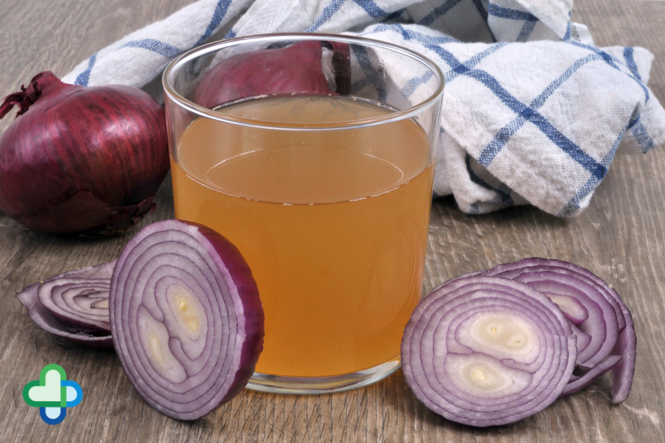 onion juice for hair loss