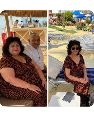 Before and after progress photo of a woman in tiger pattern dress on the beach